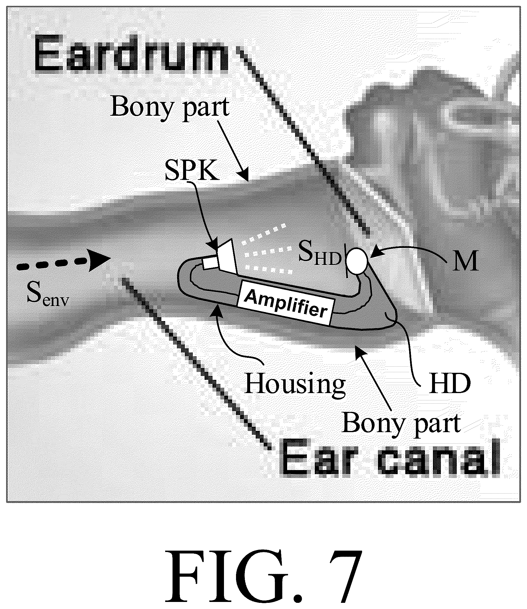 Patent US12621613 Figure 7 – Method of detecting a sudden change in a feedback/echo path of a hearing aid