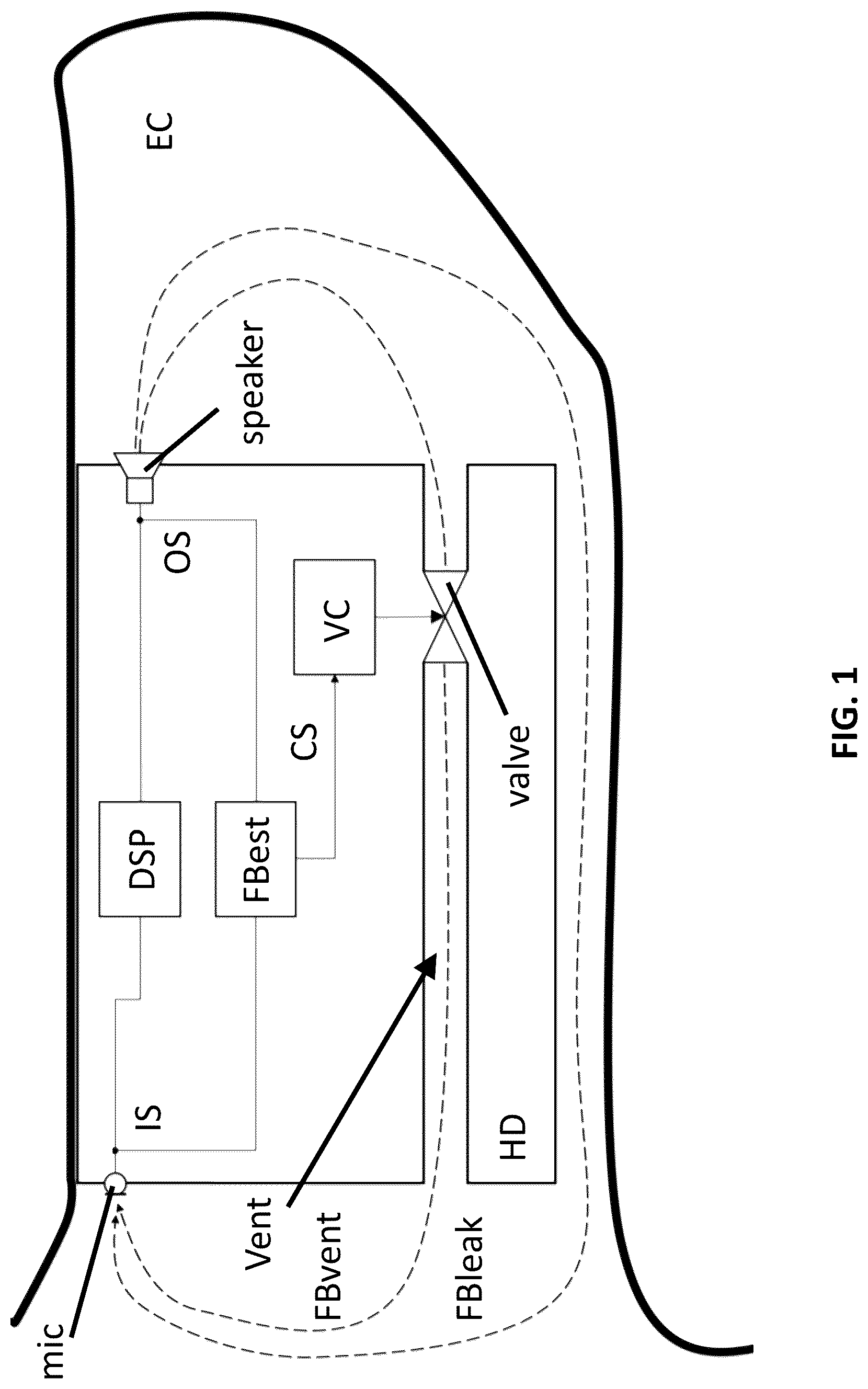 Patent US12621614 Figure 1 – Hearing device comprising an adjustable vent