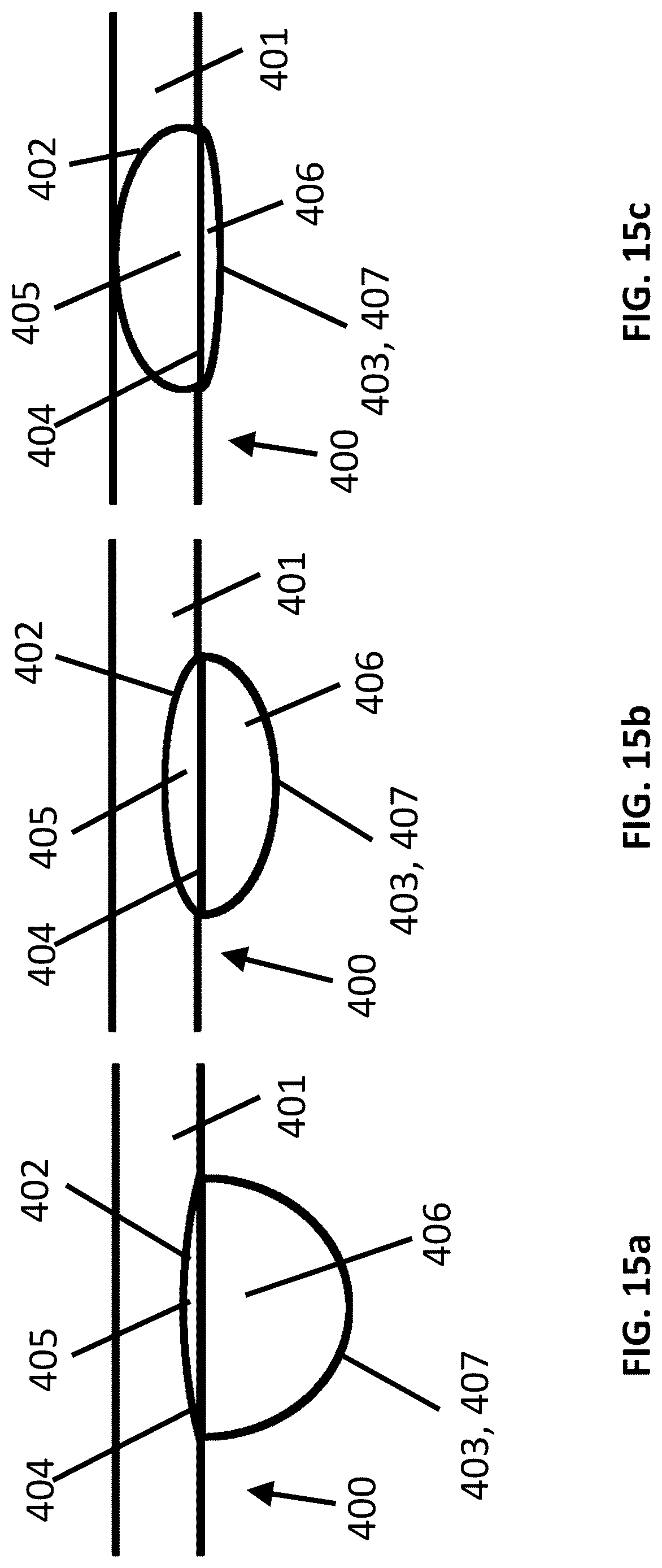 Patent US12621614 Figure 15 – Hearing device comprising an adjustable vent