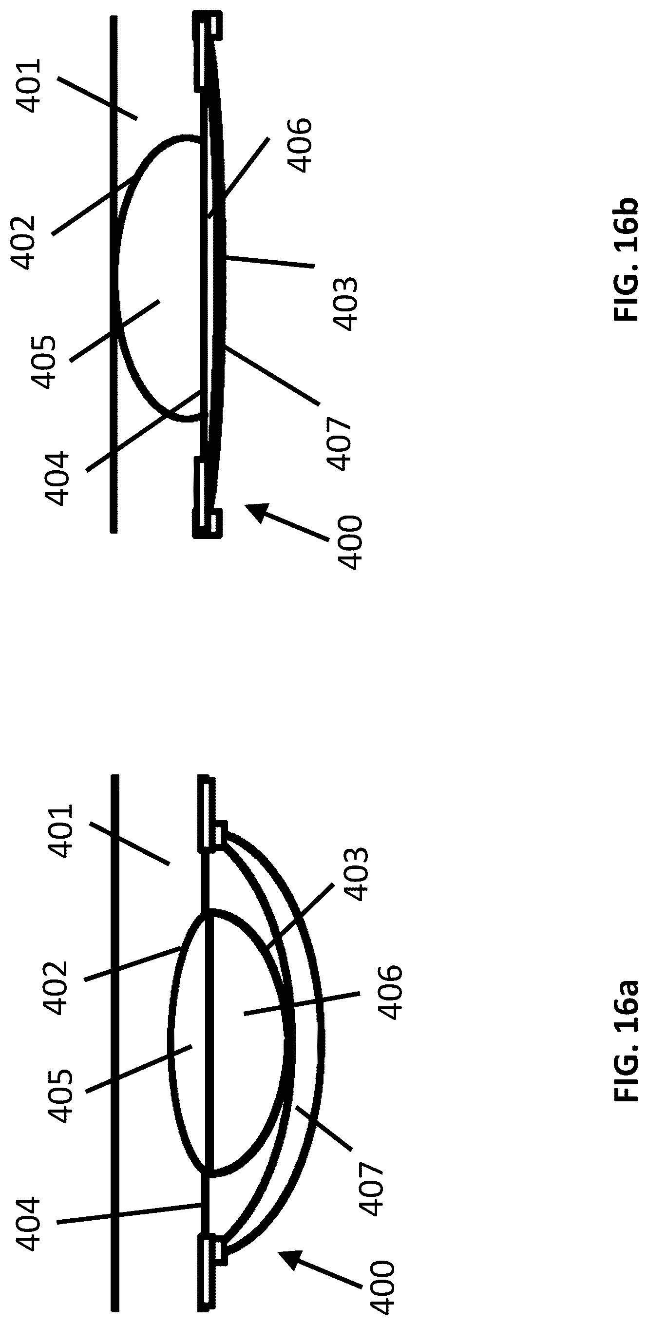 Patent US12621614 Figure 16 – Hearing device comprising an adjustable vent
