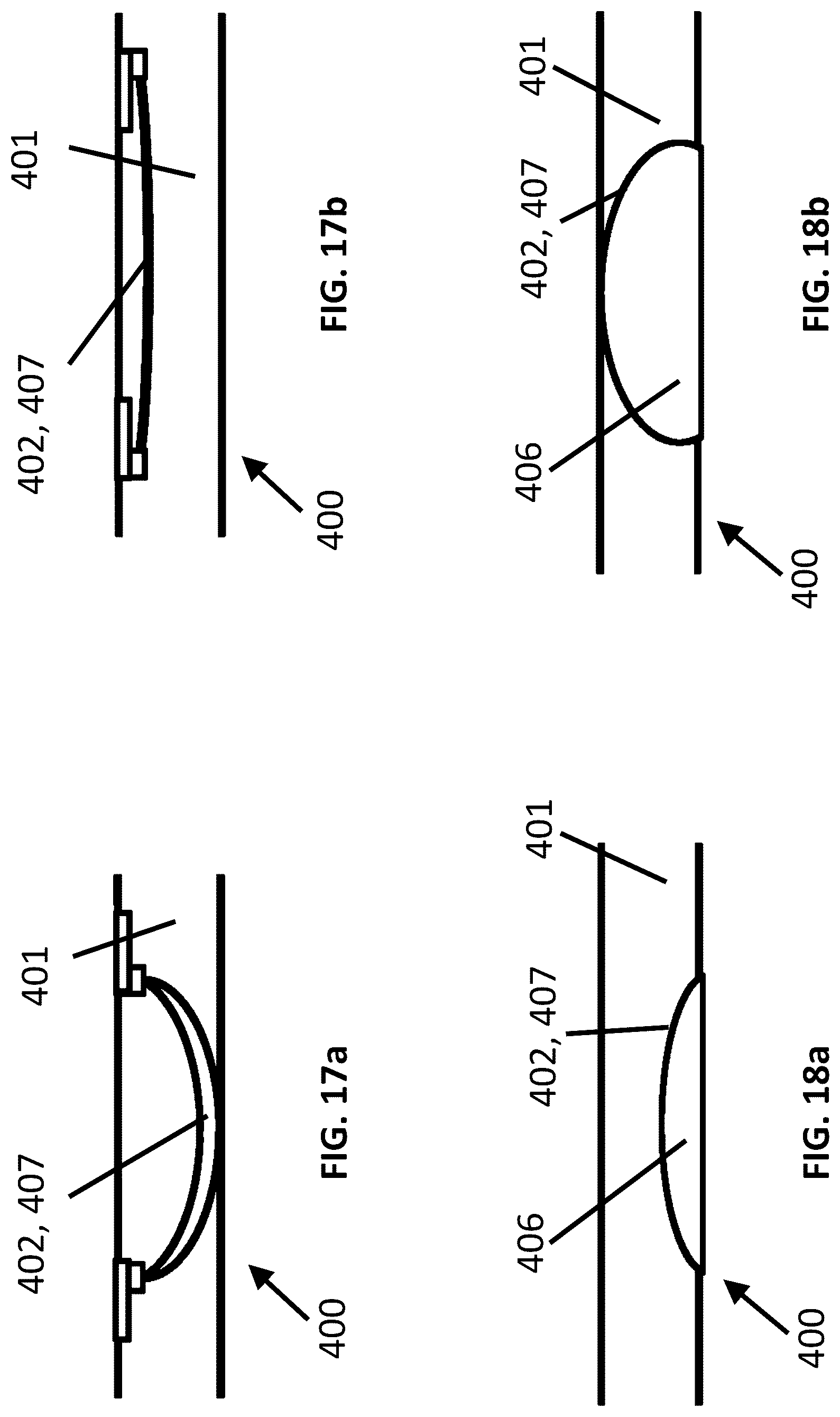 Patent US12621614 Figure 17 – Hearing device comprising an adjustable vent