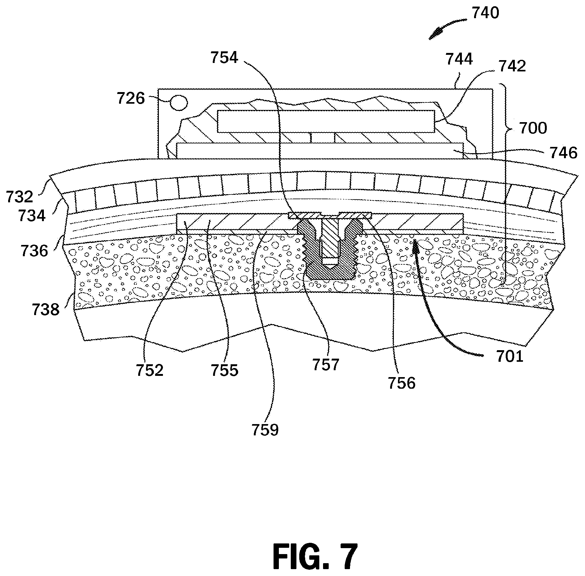 Patent US12621617 Figure 7 – Musical perception of a recipient of an auditory device