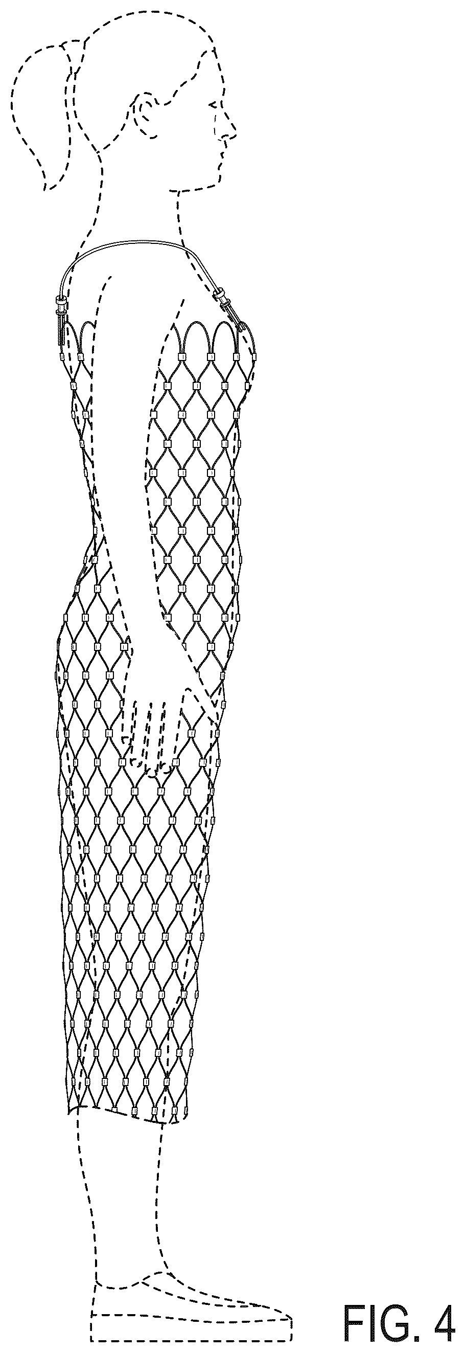 Patent USD1123309 Figure 4 – Tube garment of metal cable mesh