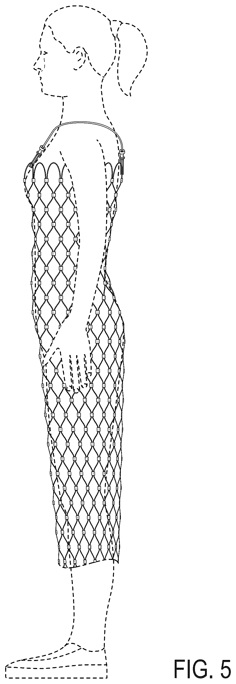 Patent USD1123309 Figure 5 – Tube garment of metal cable mesh