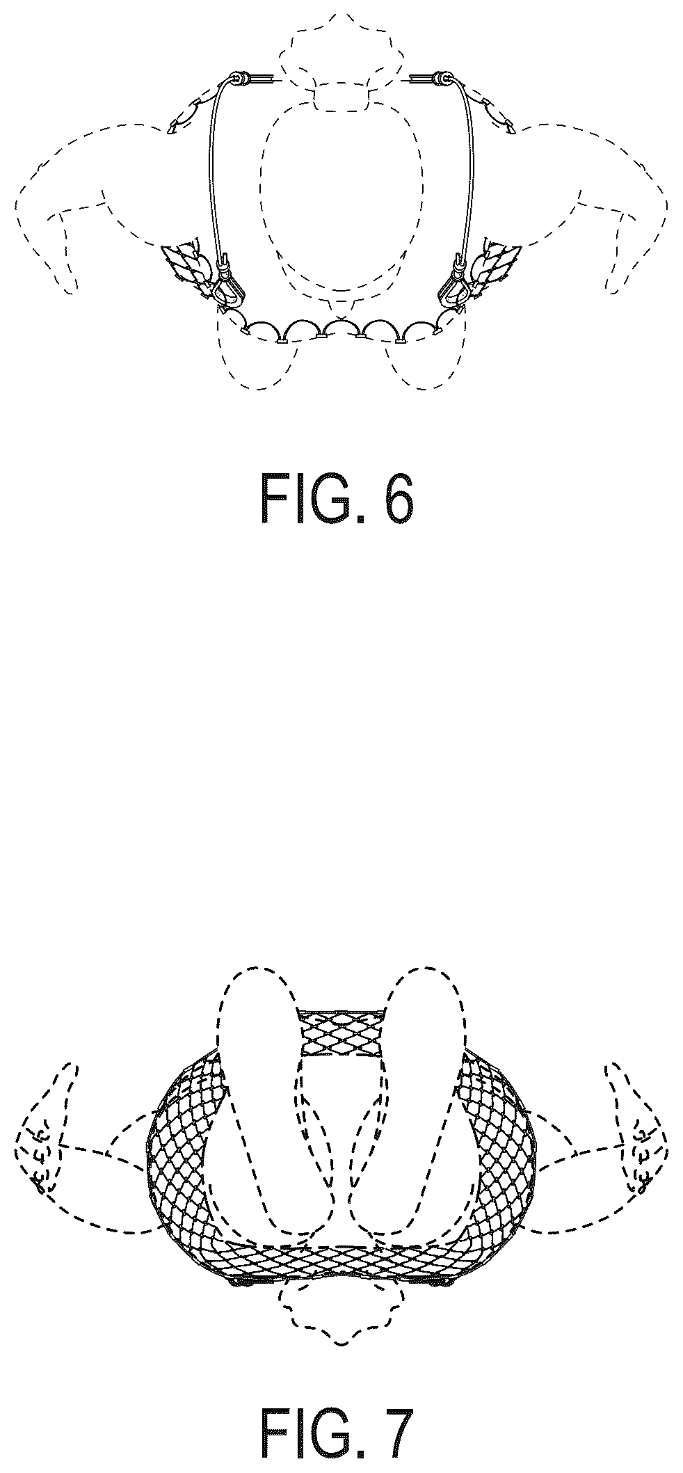 Patent USD1123309 Figure 6 – Tube garment of metal cable mesh