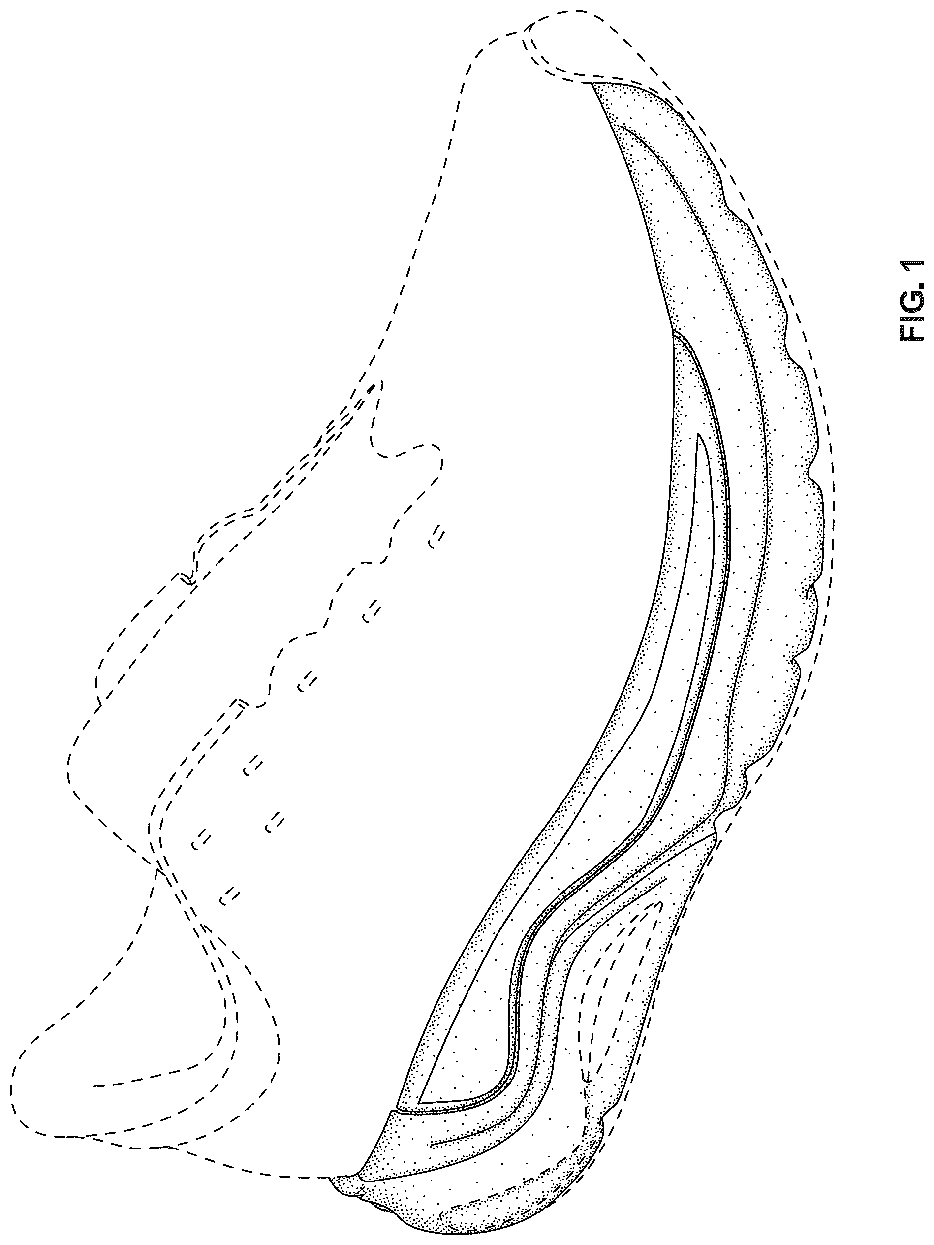 Patent USD1123340 Figure 1 – Footwear midsole