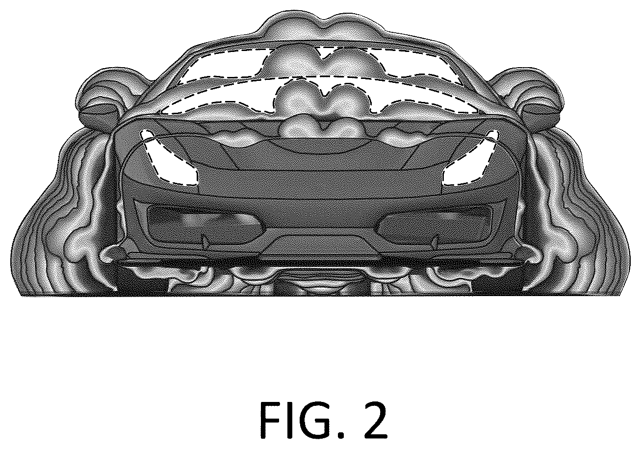 Patent USD1123706 Figure 2 – Decorative ornament