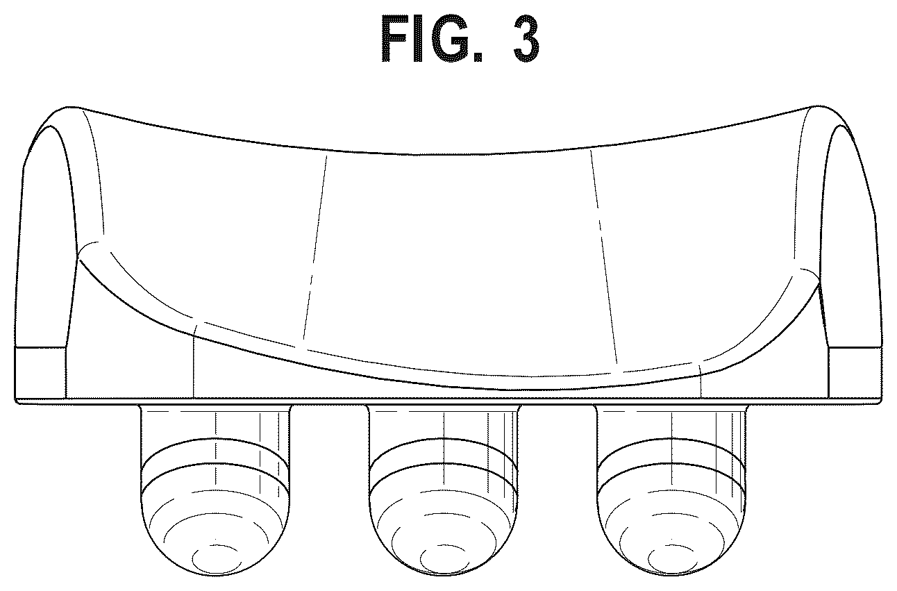 Patent USD1124342 Figure 3 – Talus implant