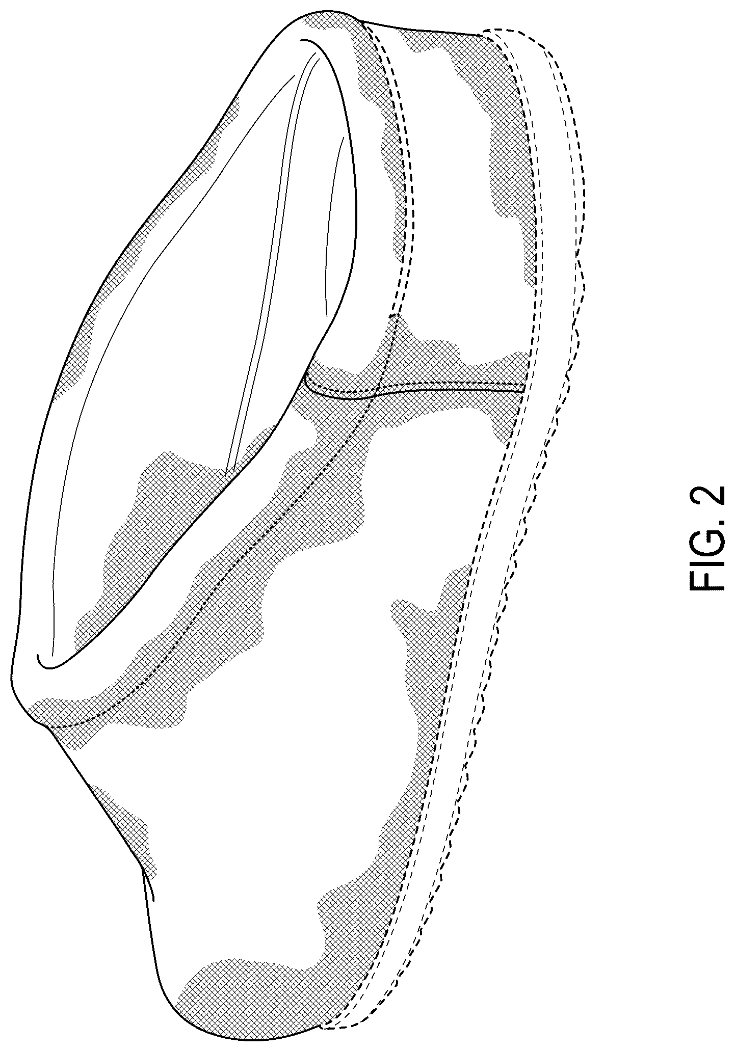 Patent USD1124601 Figure 2 – Shoe