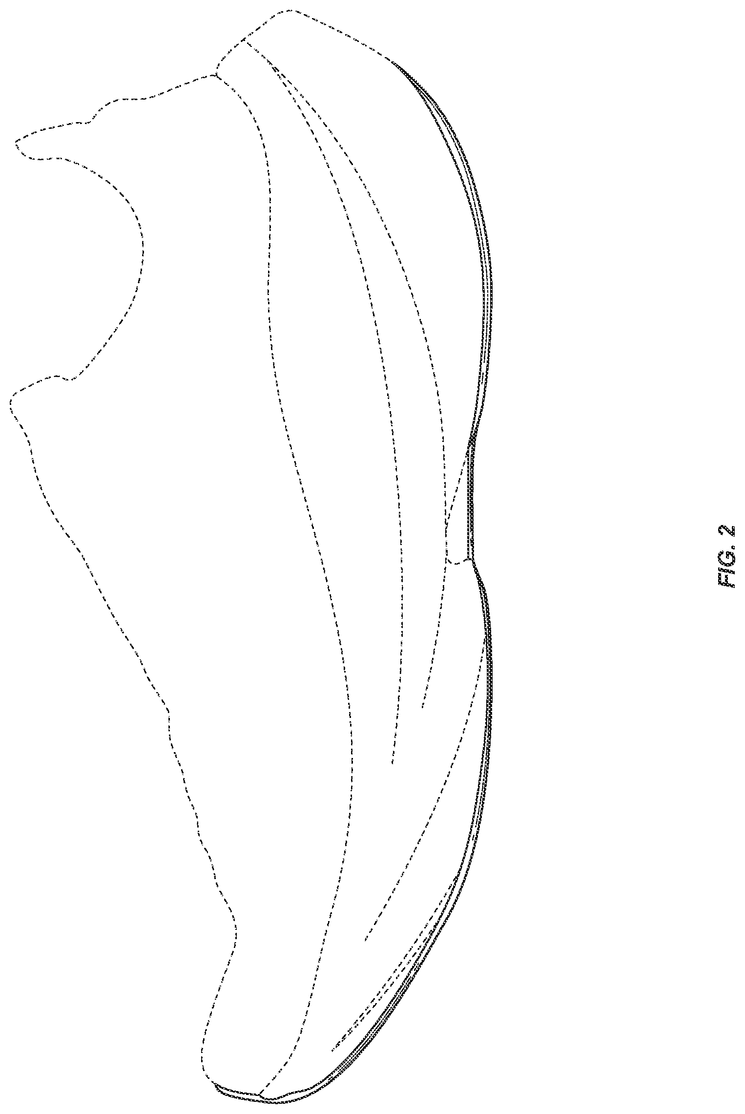 Patent USD1124615 Figure 2 – Outsole bottom