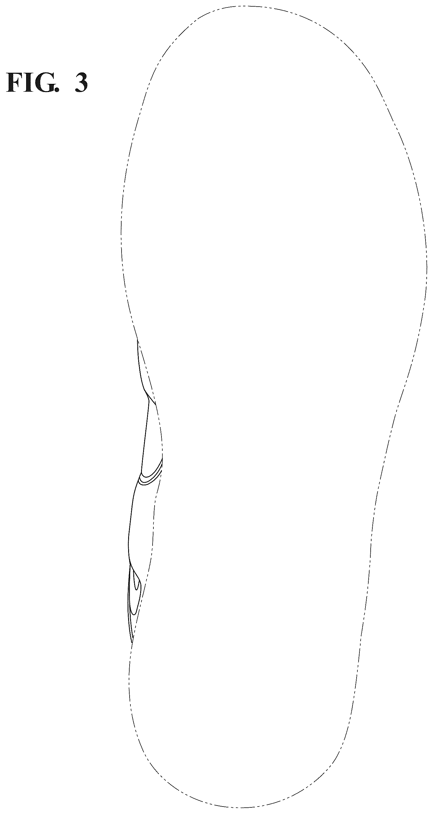 Patent USD1124622 Figure 3 – Footwear upper