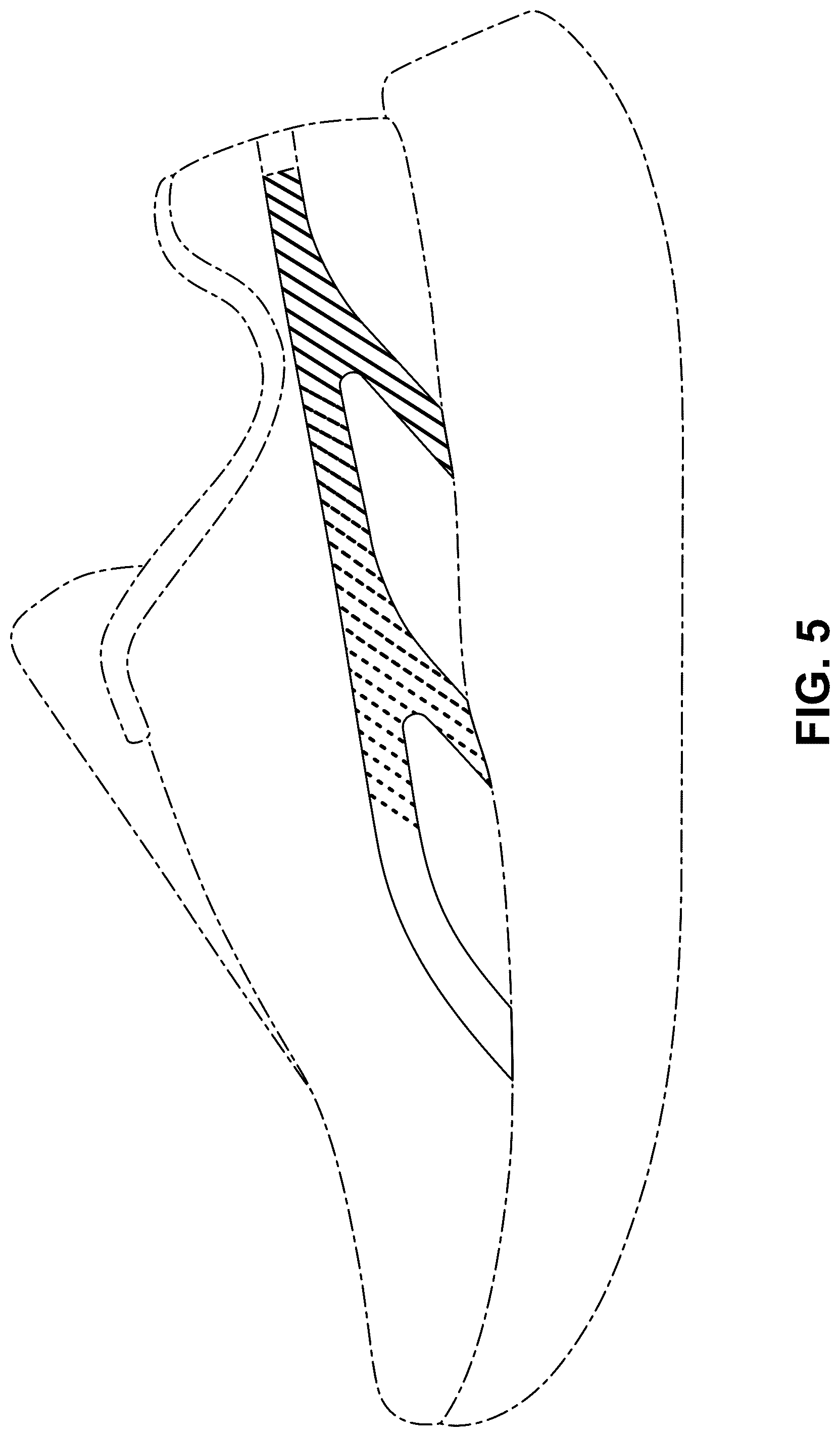 Patent USD1124623 Figure 5 – Shoe