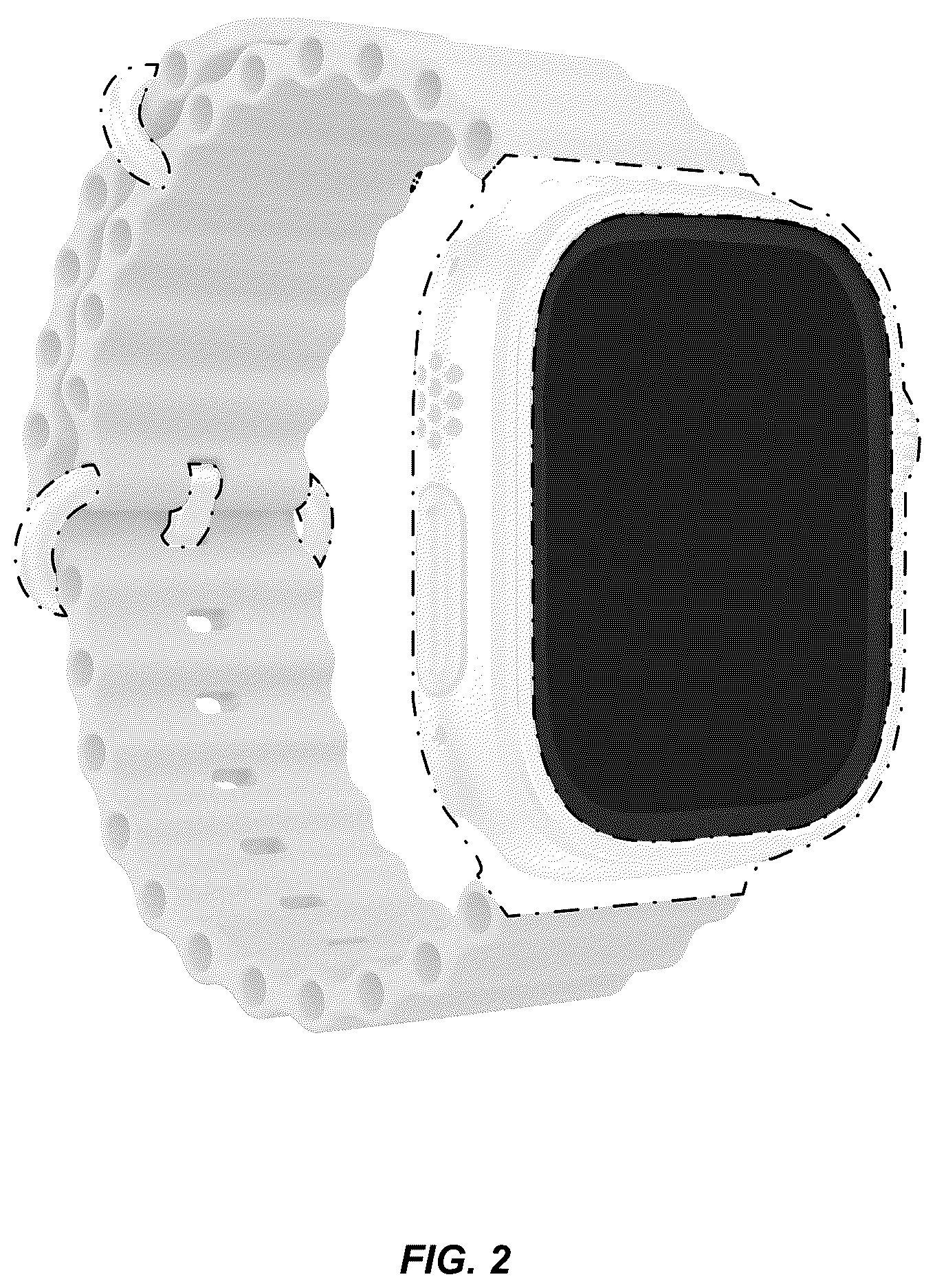 Patent USD1125157 Figure 2 – Wearable device