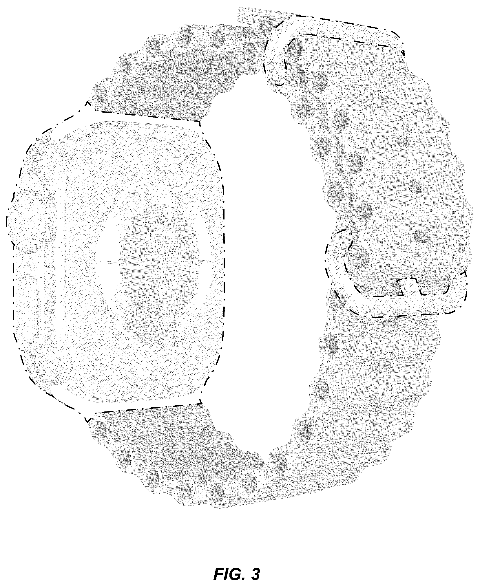 Patent USD1125157 Figure 3 – Wearable device
