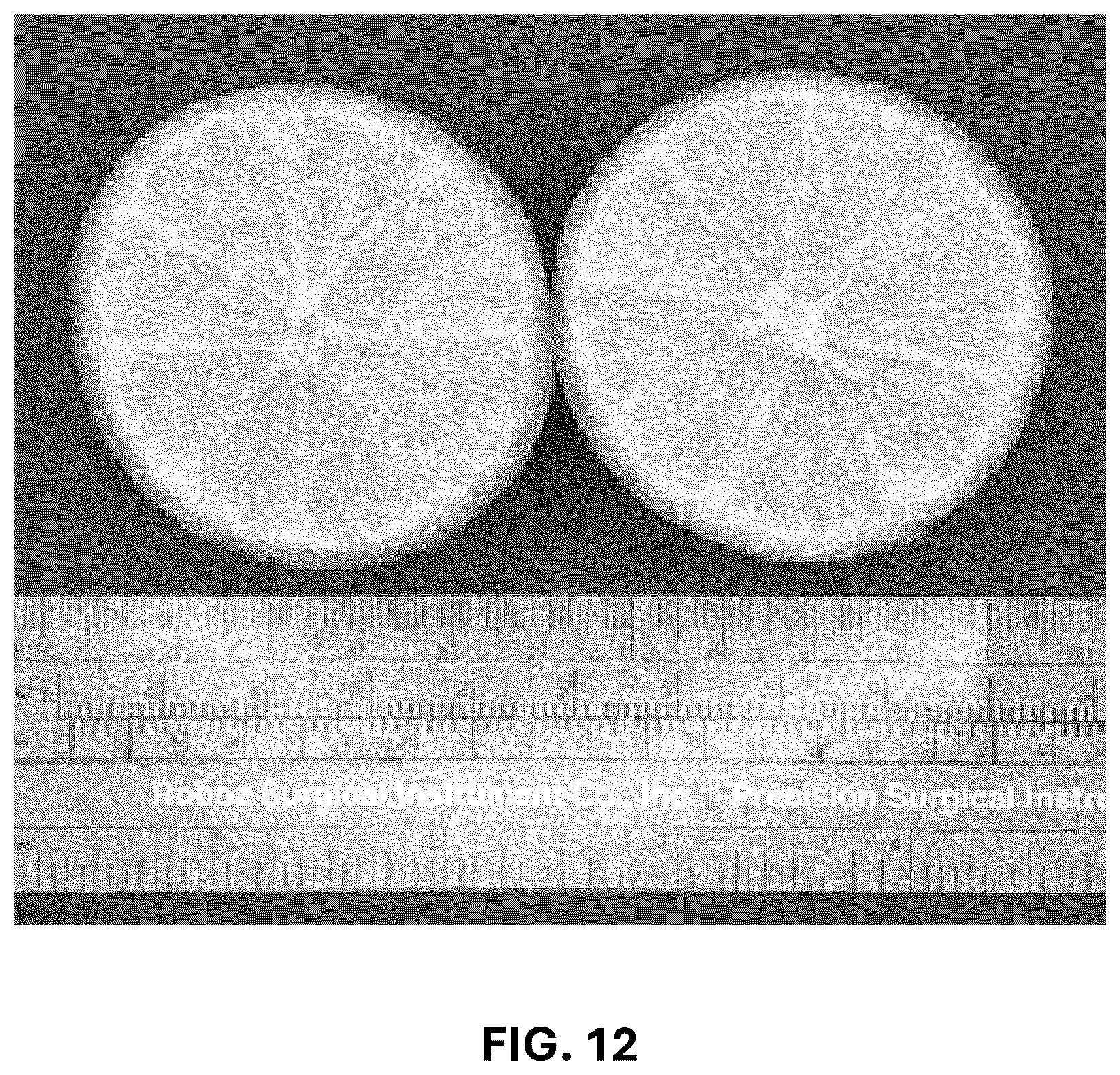 Patent USPP037293 Figure 10 – Hybrid lime plant named ‘C4-5-14’